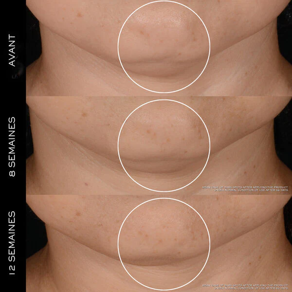 Lancôme Rénergie - Coffret Crème H.P.N. 300-Péptide – Image 5