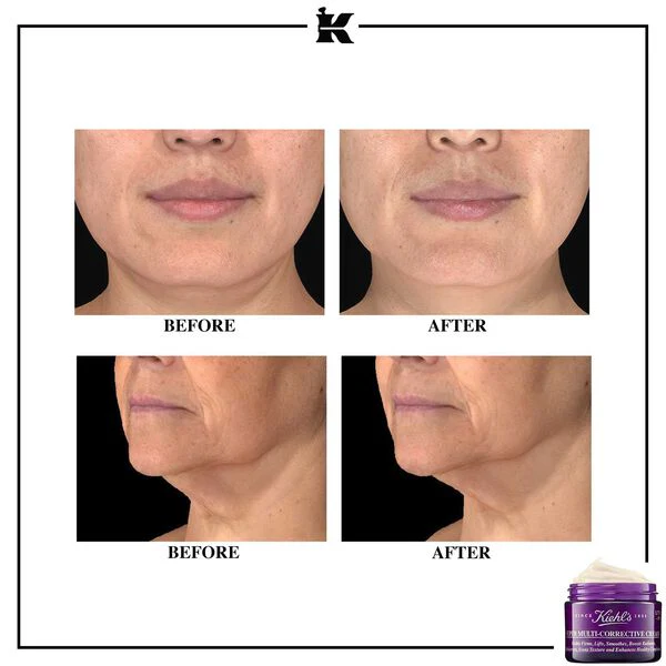 Kiehl’s - Super Multi-Corrective Cream – Image 3