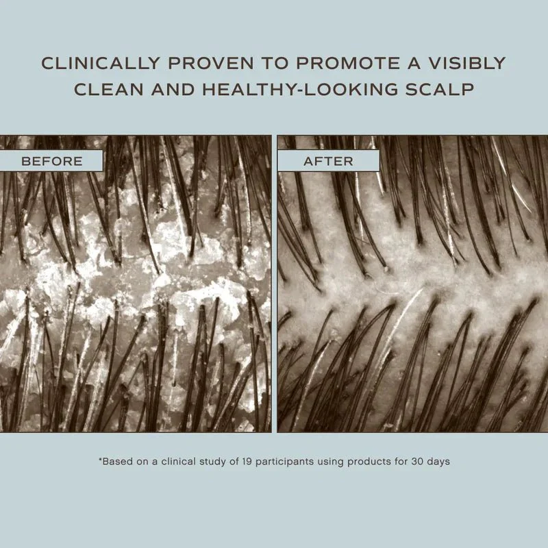 Bain capillaire pour le cuir chevelu – Image 3