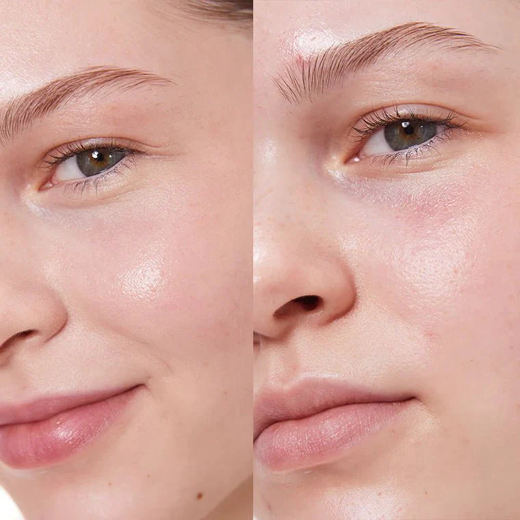 Baume Correcteur 5g – Image 5